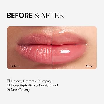 VT COSMETICS Reedle Shot Lip Plumper Set (6 Colors + Silicone Keyring), Glossy Shine, Intense Lip Plump, Hydrating & Volumizing Lip Gloss Kit, K-Beauty Lip Care Gift Set