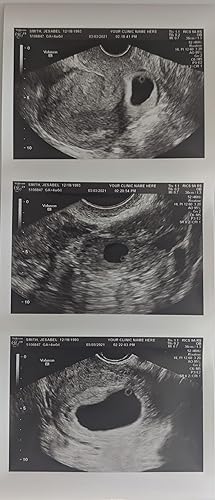 Prank 2D Customized Fake Ultrasound Strip of 3 Photos