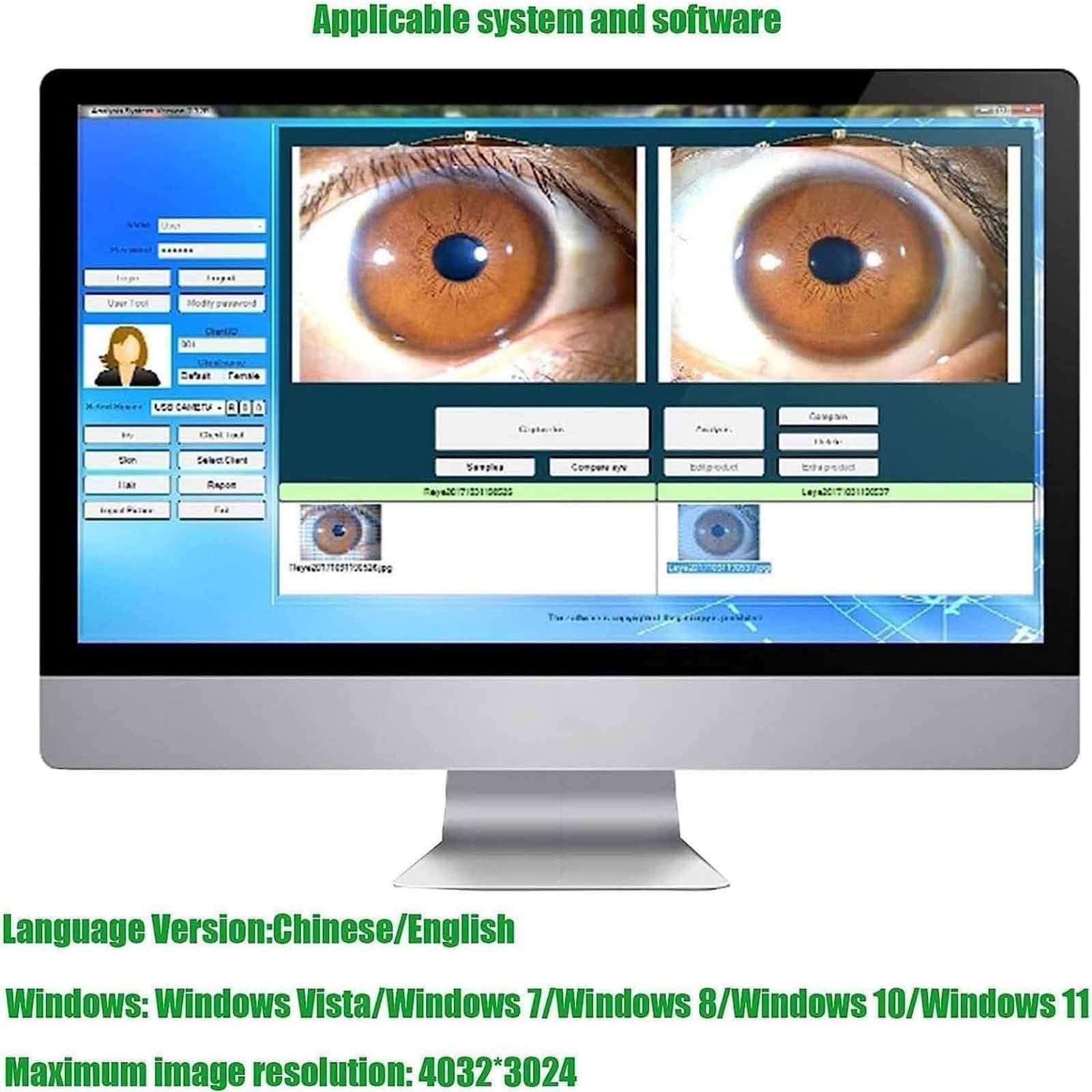 PixCy Cámara De Análisis De Iris, Iriscopio De Cámara Ocular USB De 12 MP con Lente De Iris De 30x Y Software De Análisis, Cámara De Iridología Ocular,Detector De Iris Portátil