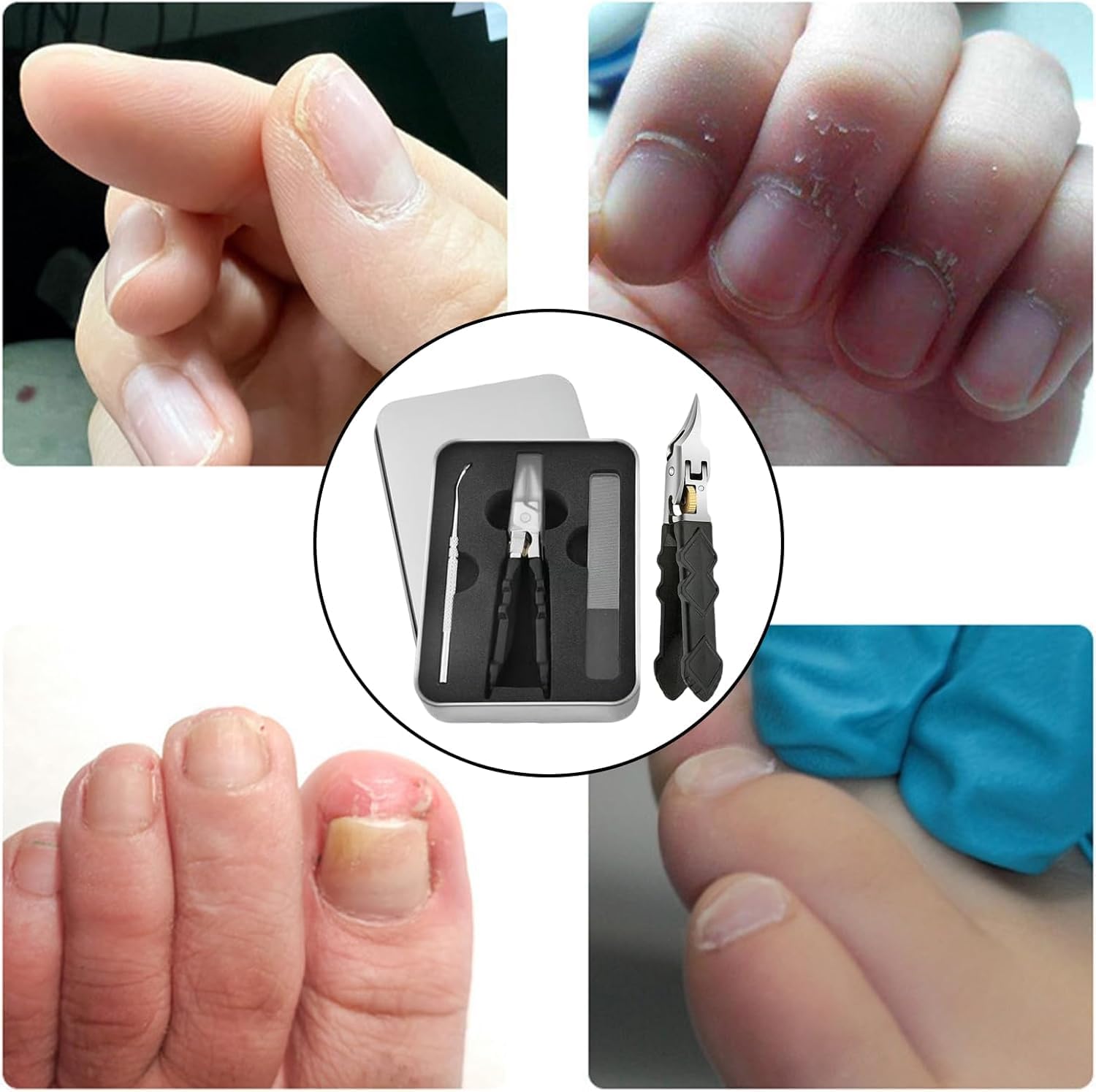 3-teiliges schwarzes Anti-Rutsch-Griff-Zahnradschloss-Nagelknipser-Set mit ultrascharfen Spitzen für präzisen Zugriff auf Nagelrillen, Edelstahl-Nagelfräser, spritzwassergeschützt, für Senioren