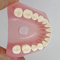 Vista 5 de Modelo de dientes de implante dental con dientes extraíbles para profesionales dentales y estudiantes