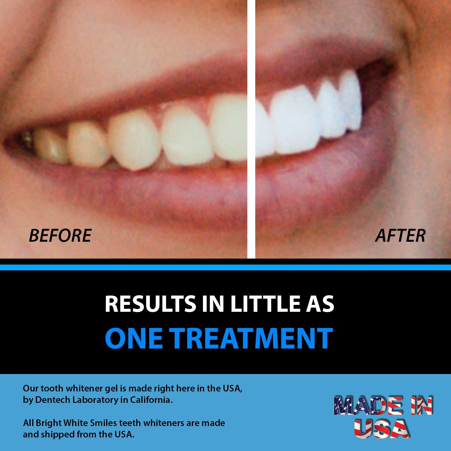 Snow Teeth Whitening Kit Review My Honest Thoughts, 48 OFF