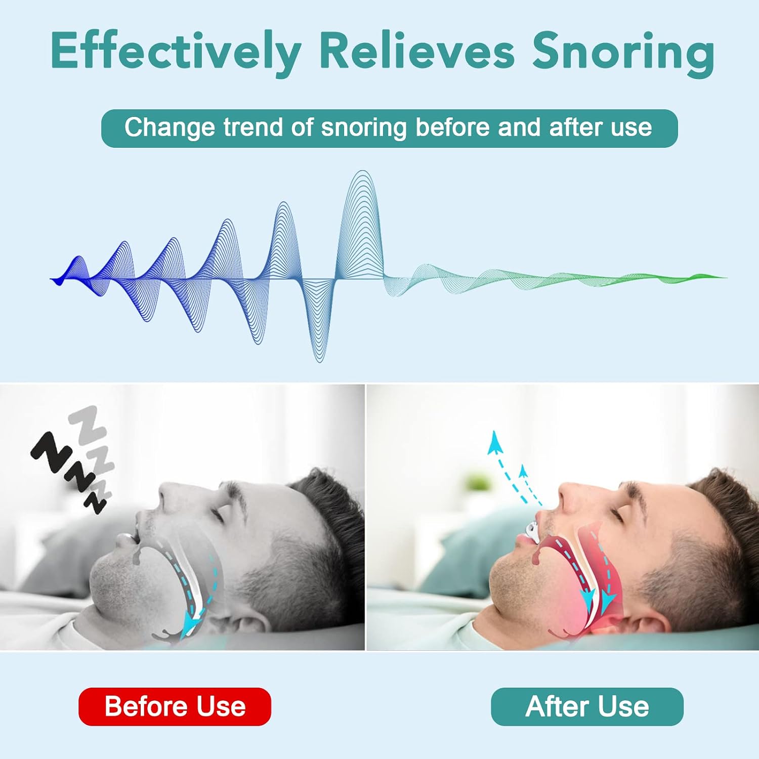 Anti Snoring Mouthpiece,Anti Snoring Device Stop Snoring,Snoring Solution Anti-Snoring Mouth Guard Comfortable,Reusable Snoring Reducing Mouthguard for Men and Women