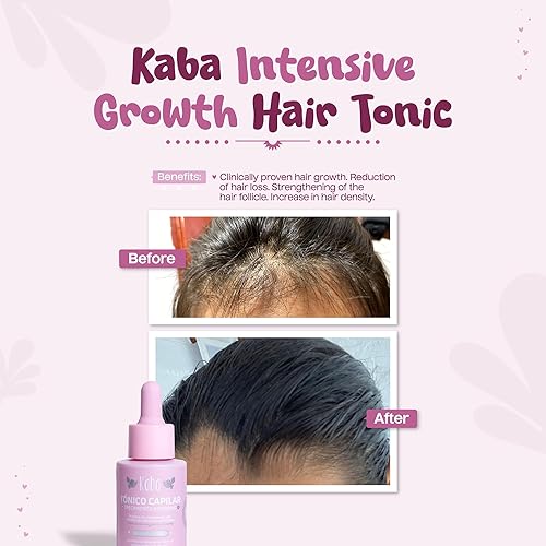 Miniatura 2 de Kaba Producto para el crecimiento del cabello, aceite para el crecimiento del cabello para un cabello más saludable, fortalece el folículo piloso,