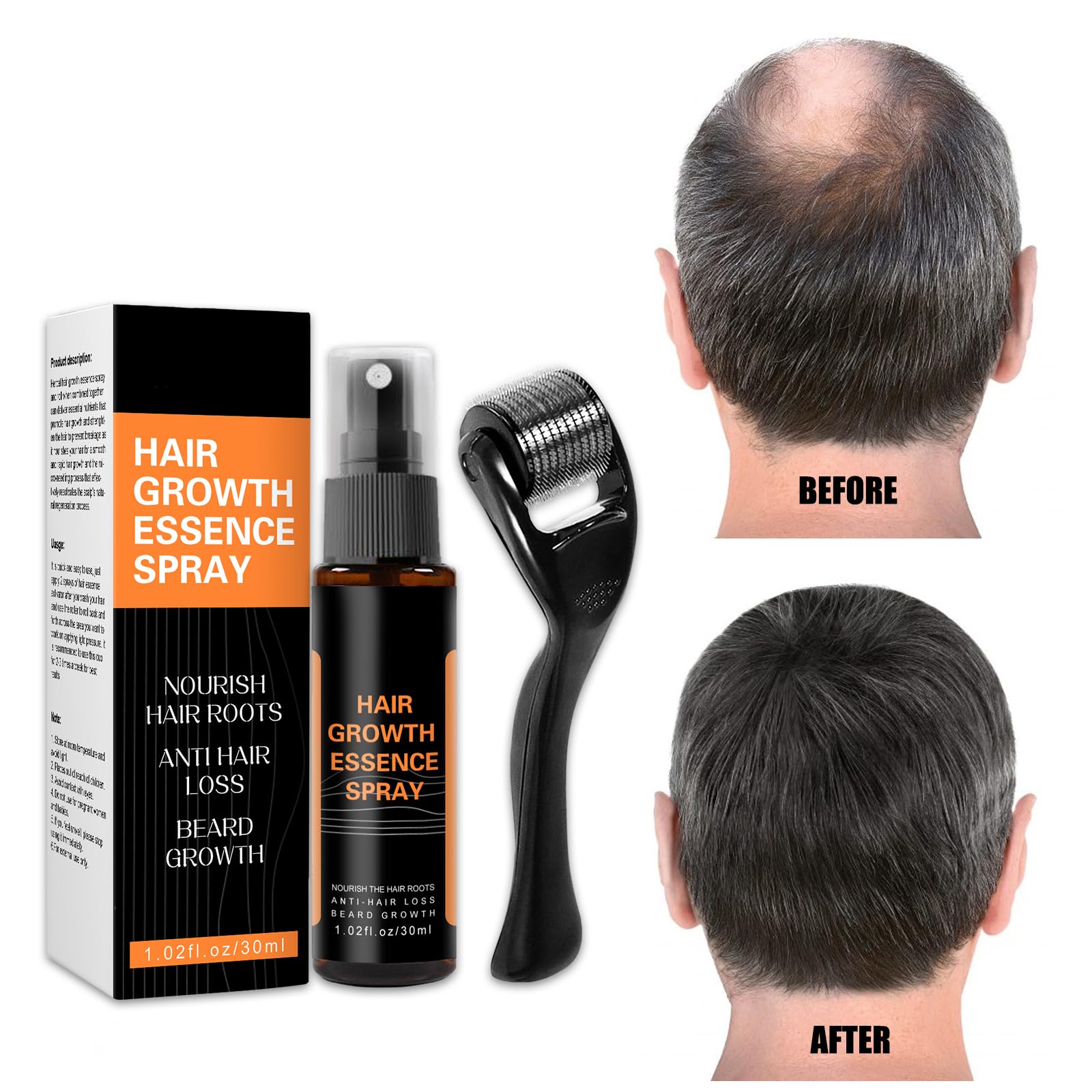 Hair Growth Essence Spray para el Crecimiento del Cabello, Spray Anticaida de Cabello y Crece Pelo, Sérum Para Crecimiento del Cabello Tratamiento para el Crecimiento, Nutrir los Folículo Piloso
