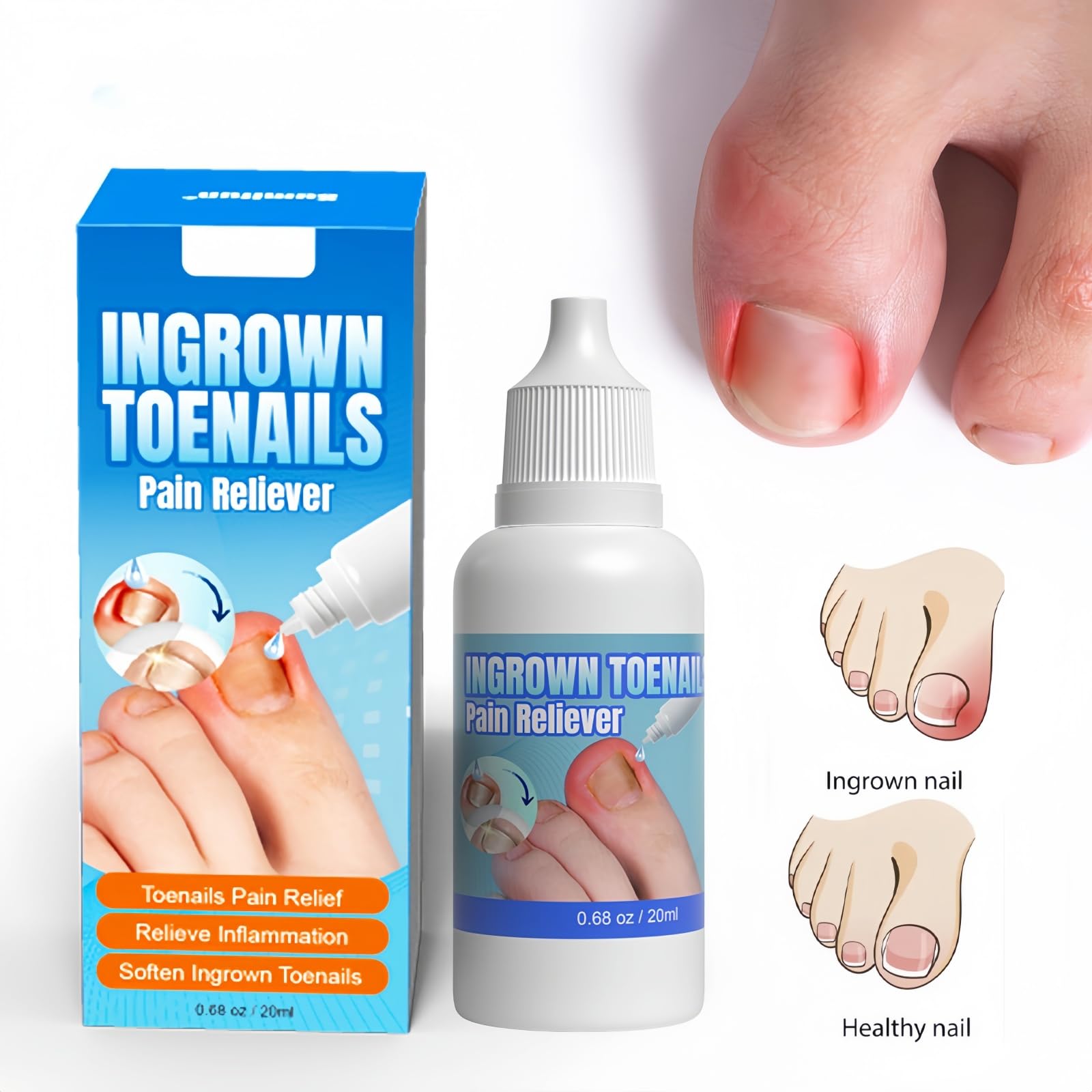 Ingrown Toenail Treatment, Ingrowing Toenail Treatment Extra-Strong, Ingrown Nail Treatments for Toenails 20ml - Image 2