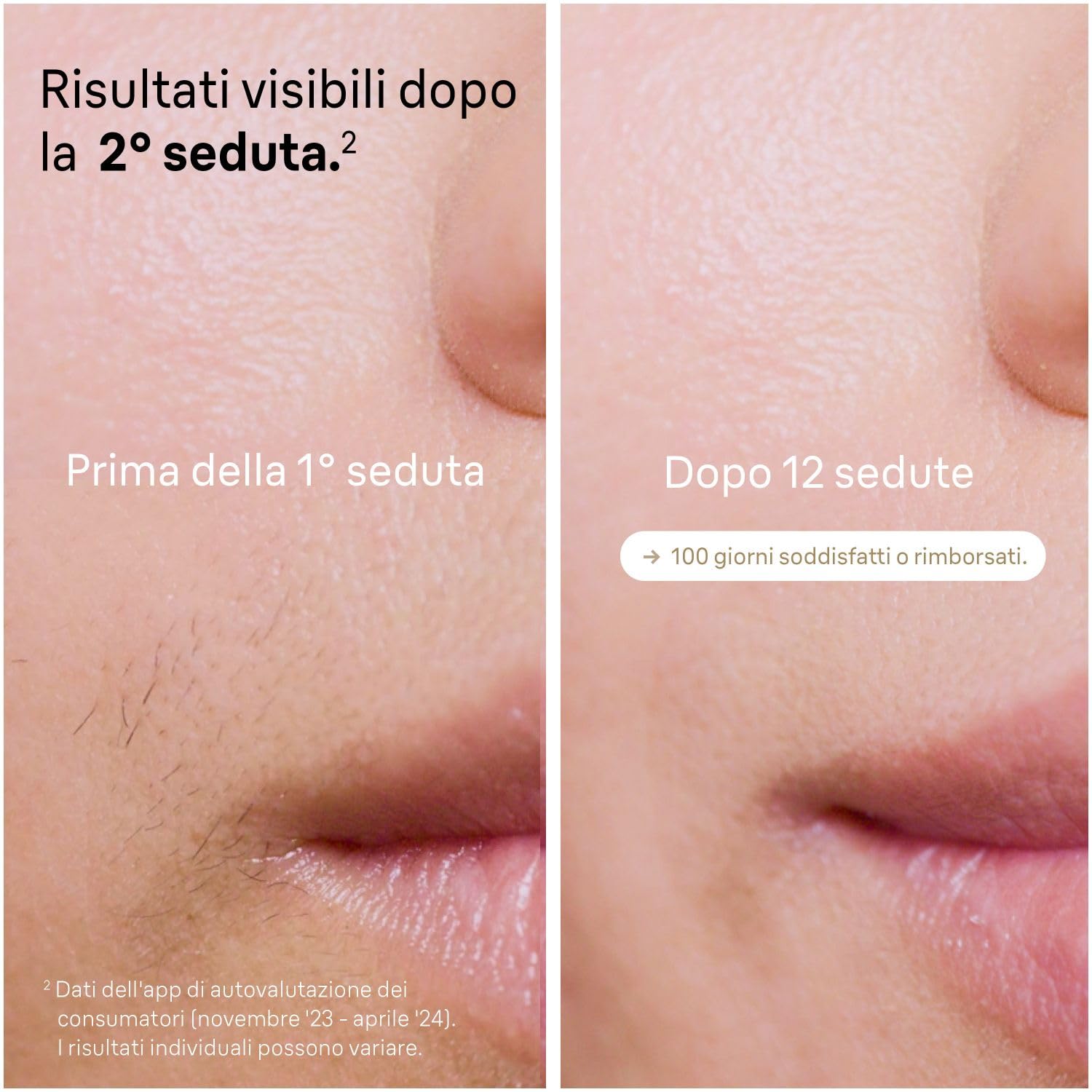 Braun Silk·expert Pro 5 Epilatore Luce Pulsata, Depilatore Corpo Donna, Alternativa al Laser Peli, Con Custodia, Rasoio Donna Venus, 4 Testine, Luce Pulsata Braun, Idea Regalo, PL5358