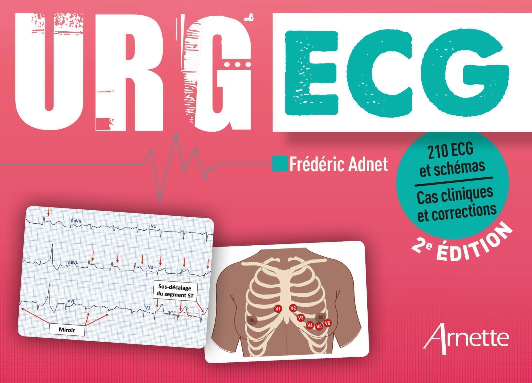 URG' ECG (2e édition): 210 ECG et schémas - Cas cliniques et corrections