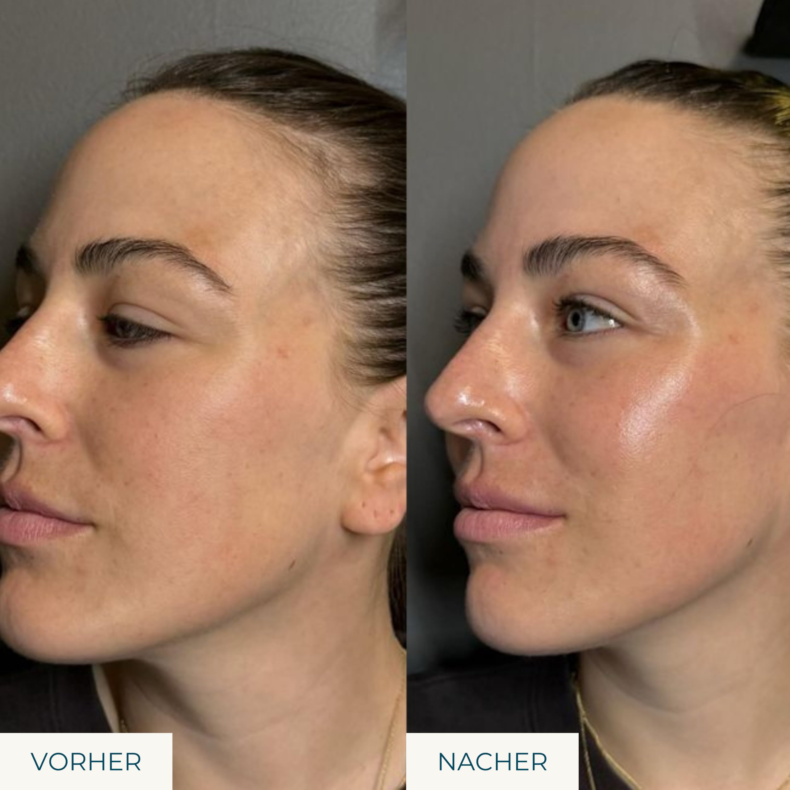 Liquid Youth – Anti-Aging Gesichtsöl mit Jojoba, Hagebutte, Sanddorn & Coenzym Q10 | Straffend & regenerierend | Vegan & mikroplastikfrei | Für reife & trockene Haut
