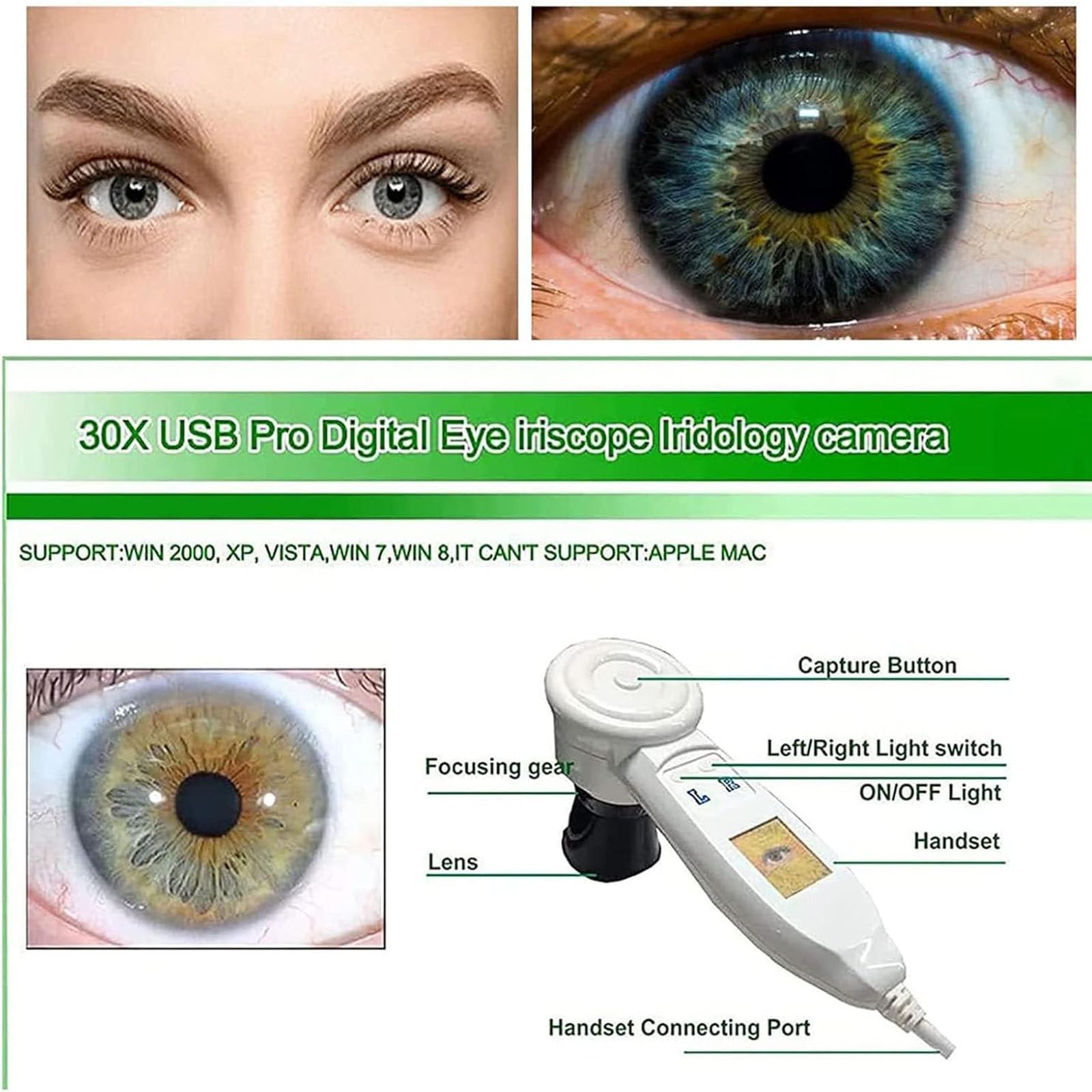 Telecamera iridoscopica medicale,Analizzatore Dell'iride Iridologia,USB iridoscopio Telecamera iridologica,Iris Software per diagnosi Eye