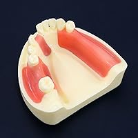 Vista 12 de Multifarious Tipos Modelo Dental Dientes Removibles Implante Ortodoncia Enseñanza Estudiar Modelos de demostración para Dentista Estudiante Escuela