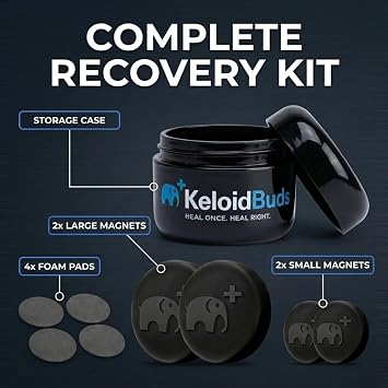KeloidBuds Pressure Earrings for Keloids - 4 Pieces of Cauliflower Ear Magnet Covered with Hypoallergenic Silicone - Keloid Earrings Pressure Clip with Neodymium Magnet Offers Optimal Compression
