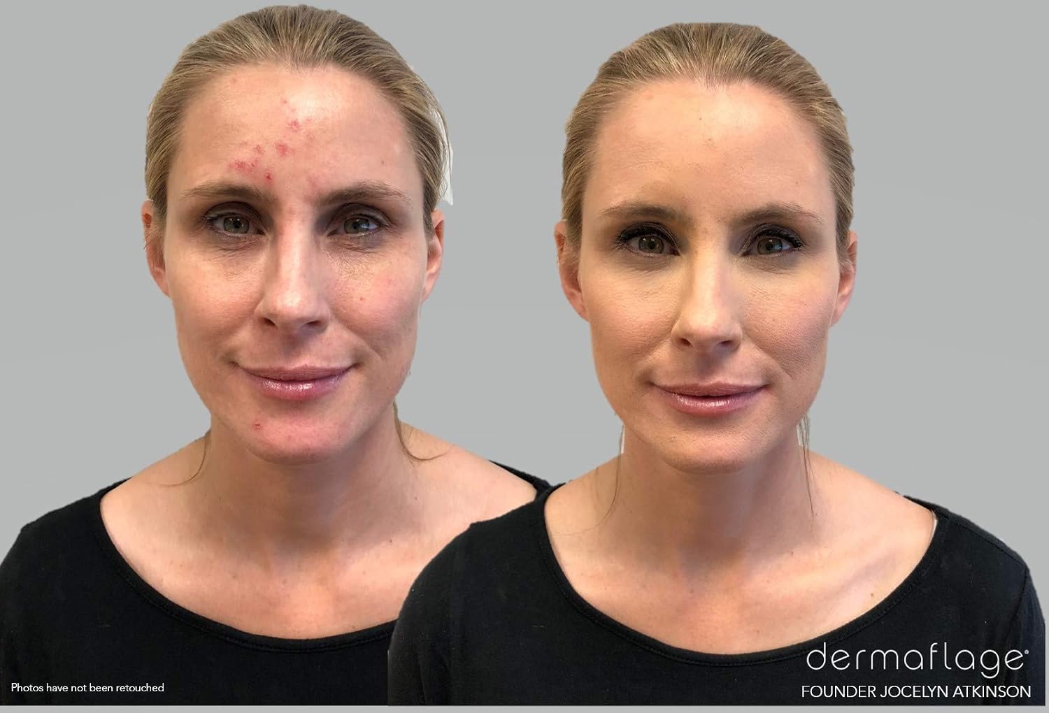 Dermaflage Waterproof Concealer Cream (Golden Fair), Concealer Full Coverage, Matte Finish for Face & Body - Image 3