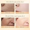 Rice Skin Care Sets, Rice Extract Double Raw Pulp Skin Care Products Set whit Facial Toner, Lotion, Facial Serum, Facial Cream and Cleanser, Improves Rough Skin, Restore Skin Elasticity(5PCS)