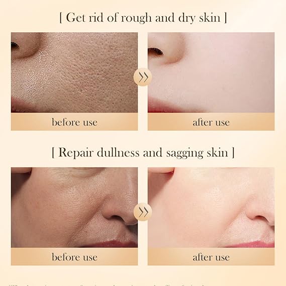 Rice Skin Care Sets, Rice Extract Double Raw Pulp Skin Care Products Set whit Facial Toner, Lotion, Facial Serum, Facial Cream and Cleanser, Improves Rough Skin, Restore Skin Elasticity(5PCS)