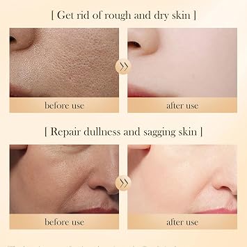 Rice Skin Care Sets, Rice Extract Double Raw Pulp Skin Care Products Set whit Facial Toner, Lotion, Facial Serum, Facial Cream and Cleanser, Improves Rough Skin, Restore Skin Elasticity(5PCS)
