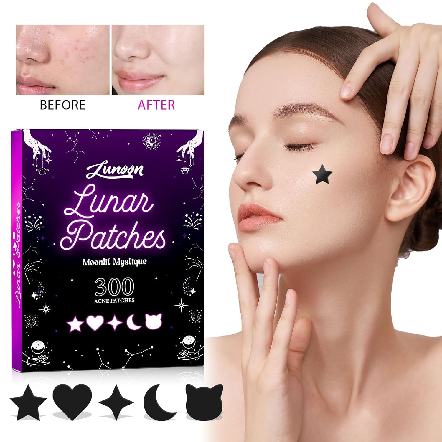 300 Pcs Black Moonlit Mystique w/Salicylic Acid & Tea Tree Oil - Pimple Patches for Face, Hydrocolloid Acne Patches, Cute Face Stickers, Zit Patches (300PCS)