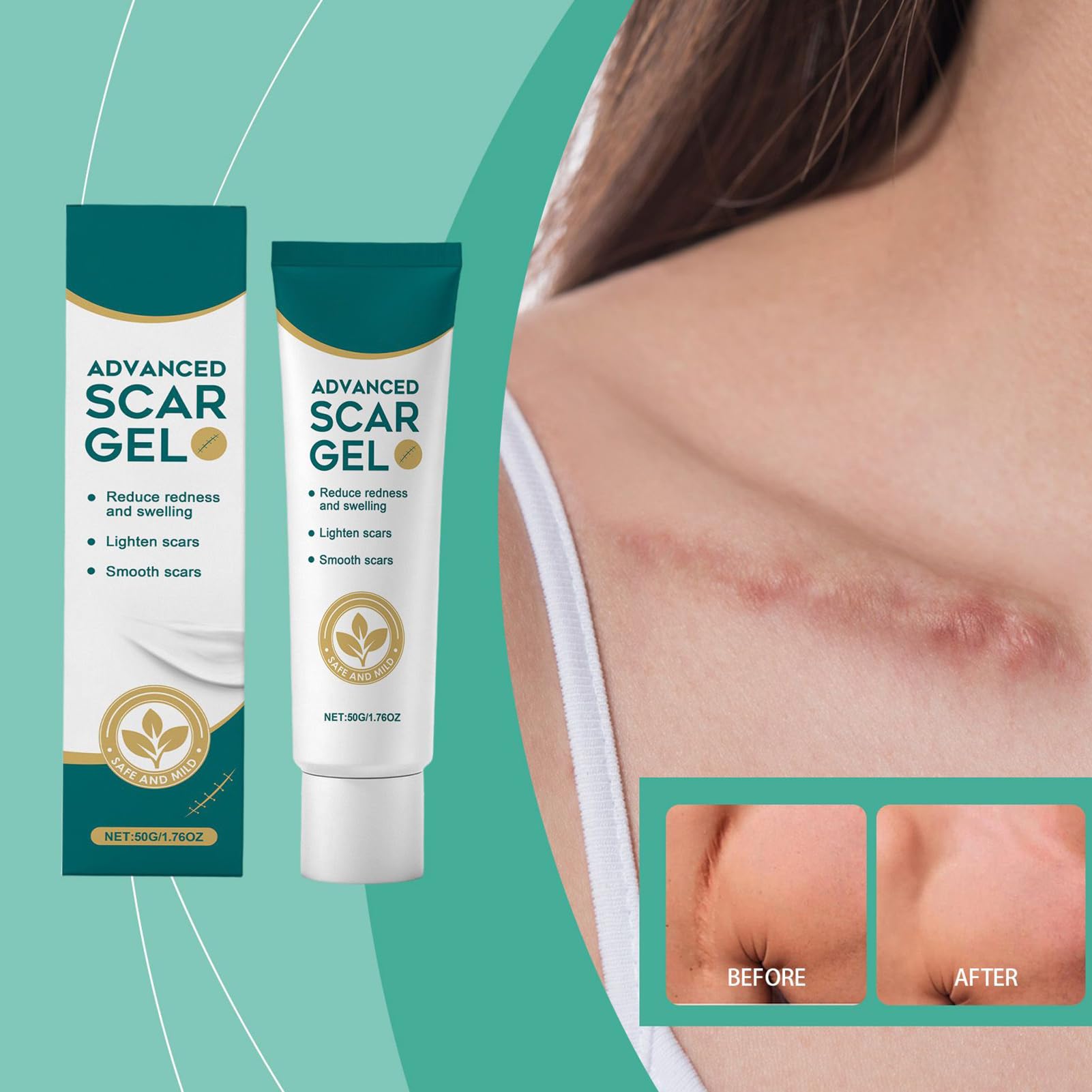 Gel de Silicona para Cicatrices - 50 Gramos Producto Para Desvanecer Marcas De Quemaduras,Nueva Crema Calmante Para Cicatrices,Para Hombres Y Mujeres, Queloides, Amantes De La Belleza, Viajeros, Rutin