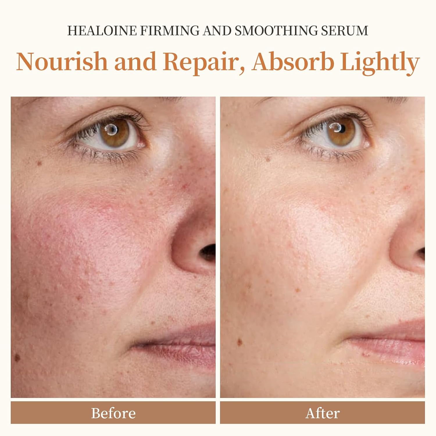 Double Peptides Serum for Face Niacinamide Hyaluronic Acid Power Repairing Essence Hydrating Serum for Face Filtrate for Dull Skin & Fine Lines, Korean Skin Care - Image 3