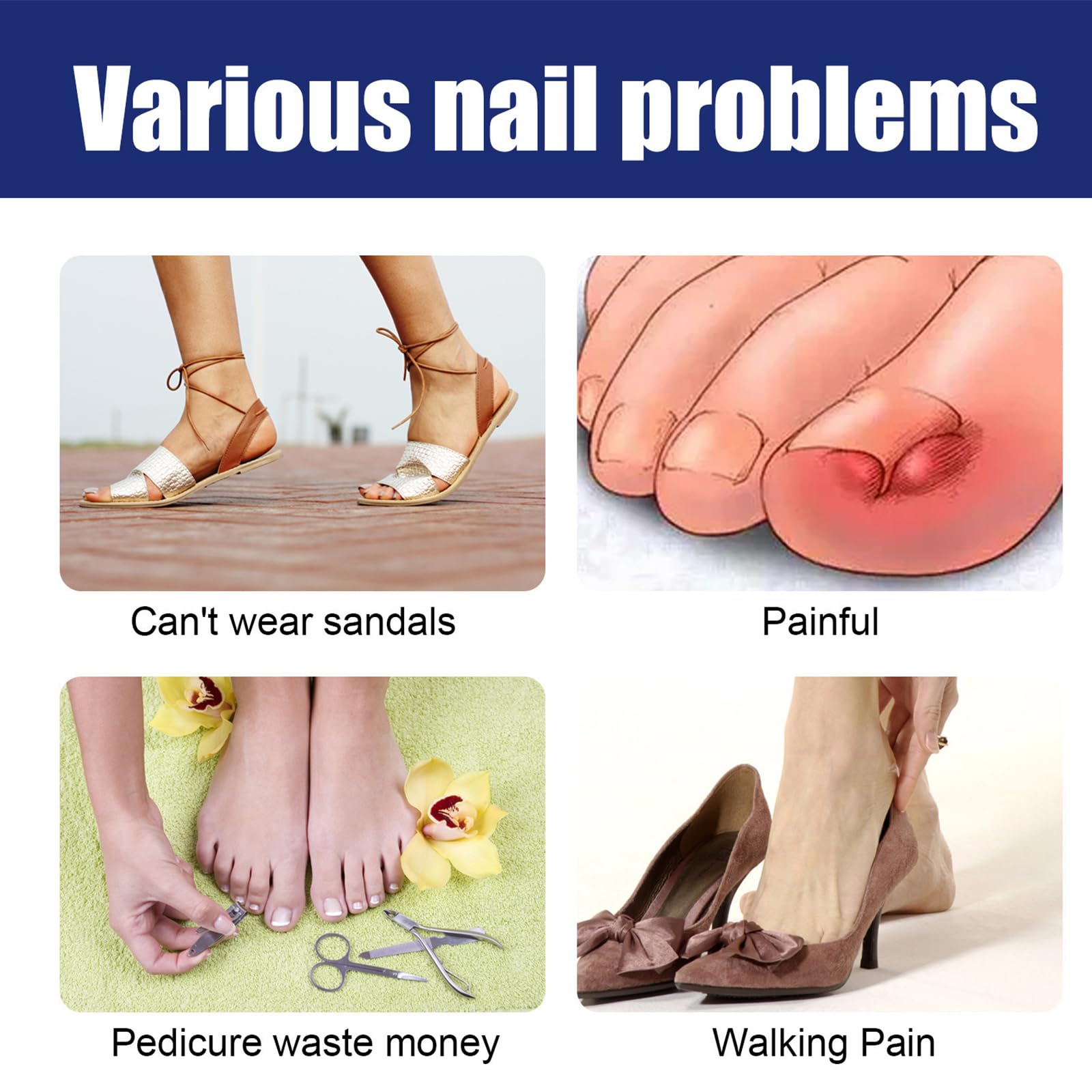 Ingrown Toenail Liquid - 30ML Ingrown Toenail Correction Drops - Nail Helper Ingrowth Toenail Oil - Trimming Toenail Softening Drops - Image 4