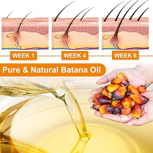 Miniatura 3 de QUNGCO Batana - Aceite hidratante para el cabello, acondicionador profundo para cabello seco