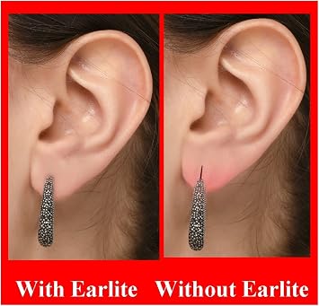 EarLite 30 patches Invisible Earring Ear Support Waterproof Patches in ZipLock Pouch - Made in USA