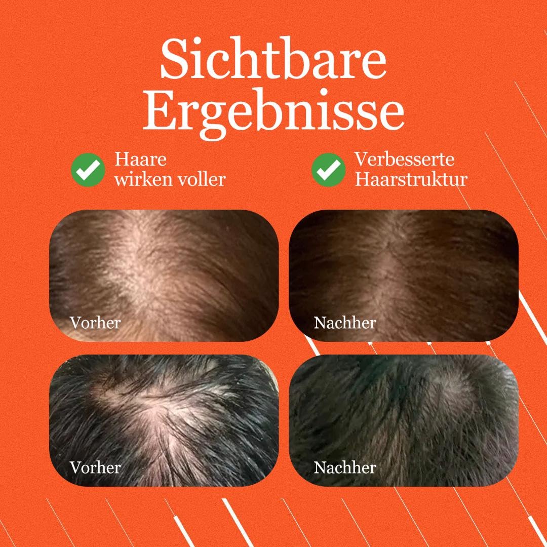 Stanartis Tricostrong® Intensive Kosmetische Kopfhaut Ampullen mit Tricofactor CPX® | Für voller und dichter wirkendes Haar | Kopfhautpflege bei dünner wirkendem Haar | 30 x 2 ml | Für Frauen & Männer