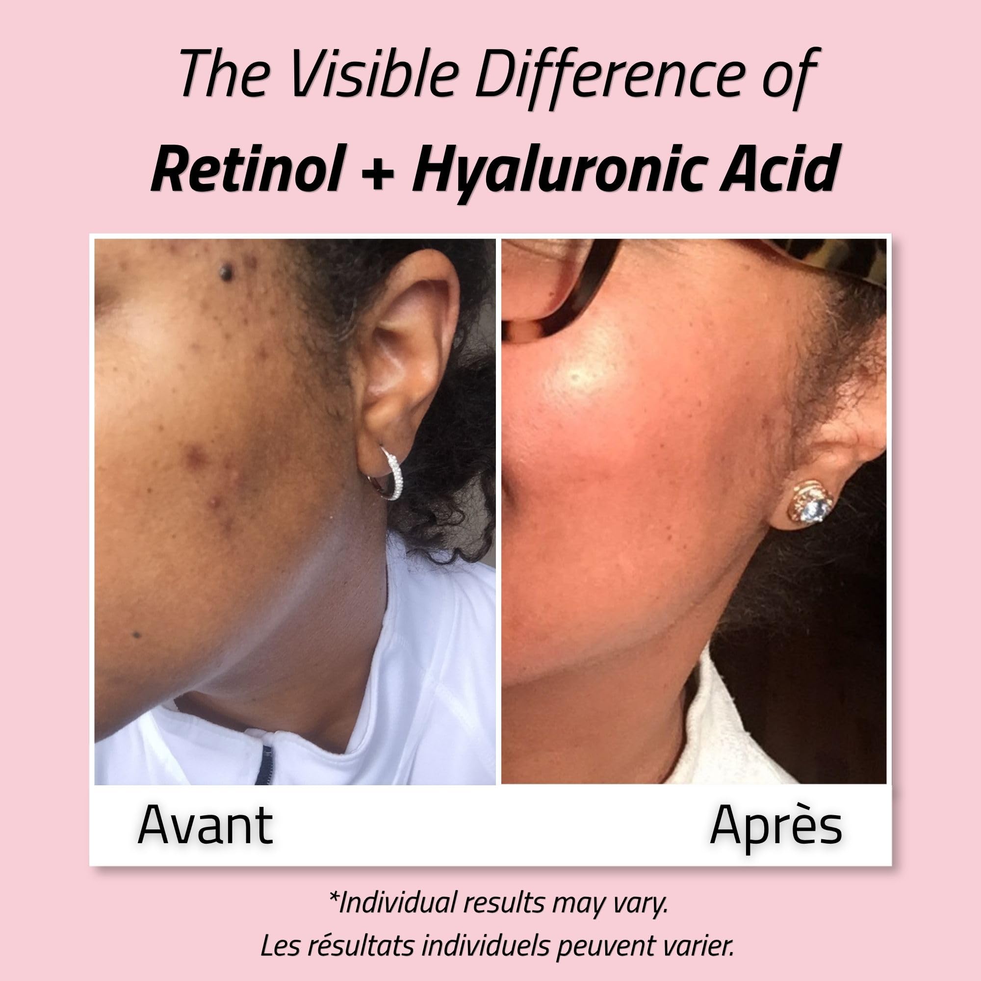YEOUTH Retinol Cream for Face, Retinolowy Krem do Twarzy dla Kobiet i Mężczyzn z Kwasem Hialuronowym i Zieloną Herbatą, Krem Nawilżający na Noc dla Gładszego Wyglądu 118ml