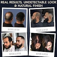 Vista 6 de Aerosol de fibras de cabello naturales, no sintético, de Hair Illusion, Negro