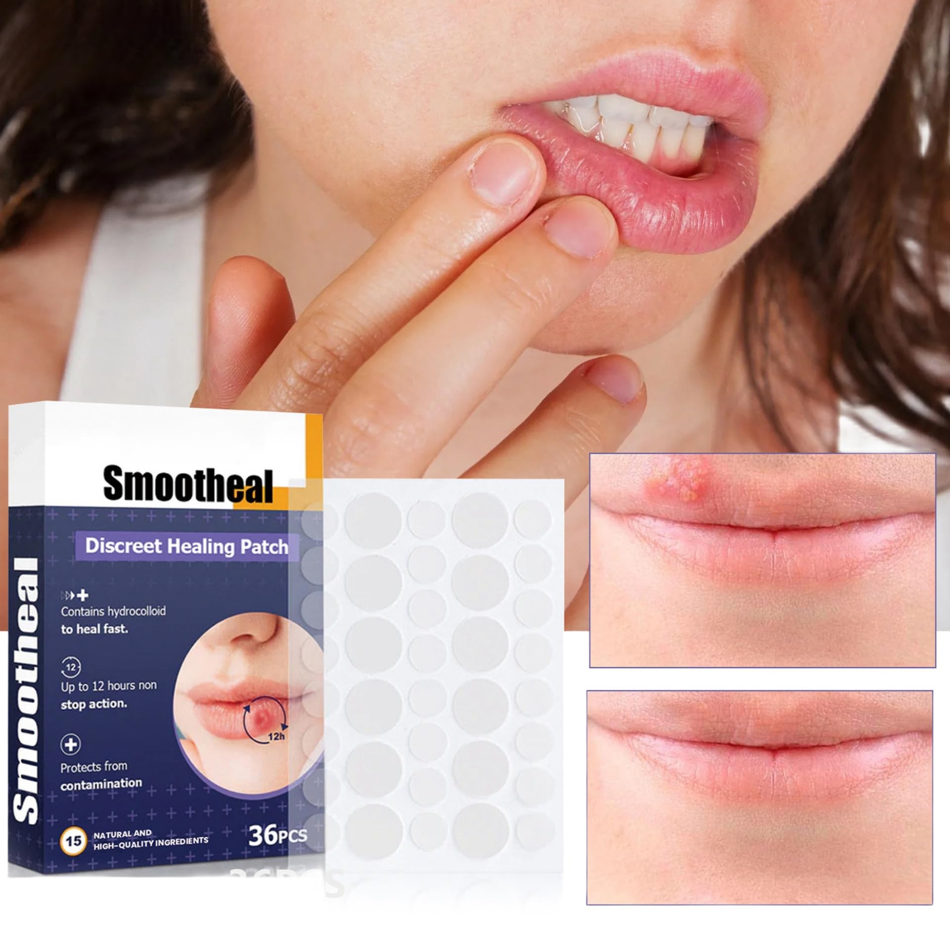 JDLYEVER Lip Care Patches 36Pcs for Treating Dry, Chapped, or Damaged Lips, Moisturizing and Nourishing Formula, Effective Smoothing and Repair, Comfortable and Non-Irritating, Fast-Acting Relief