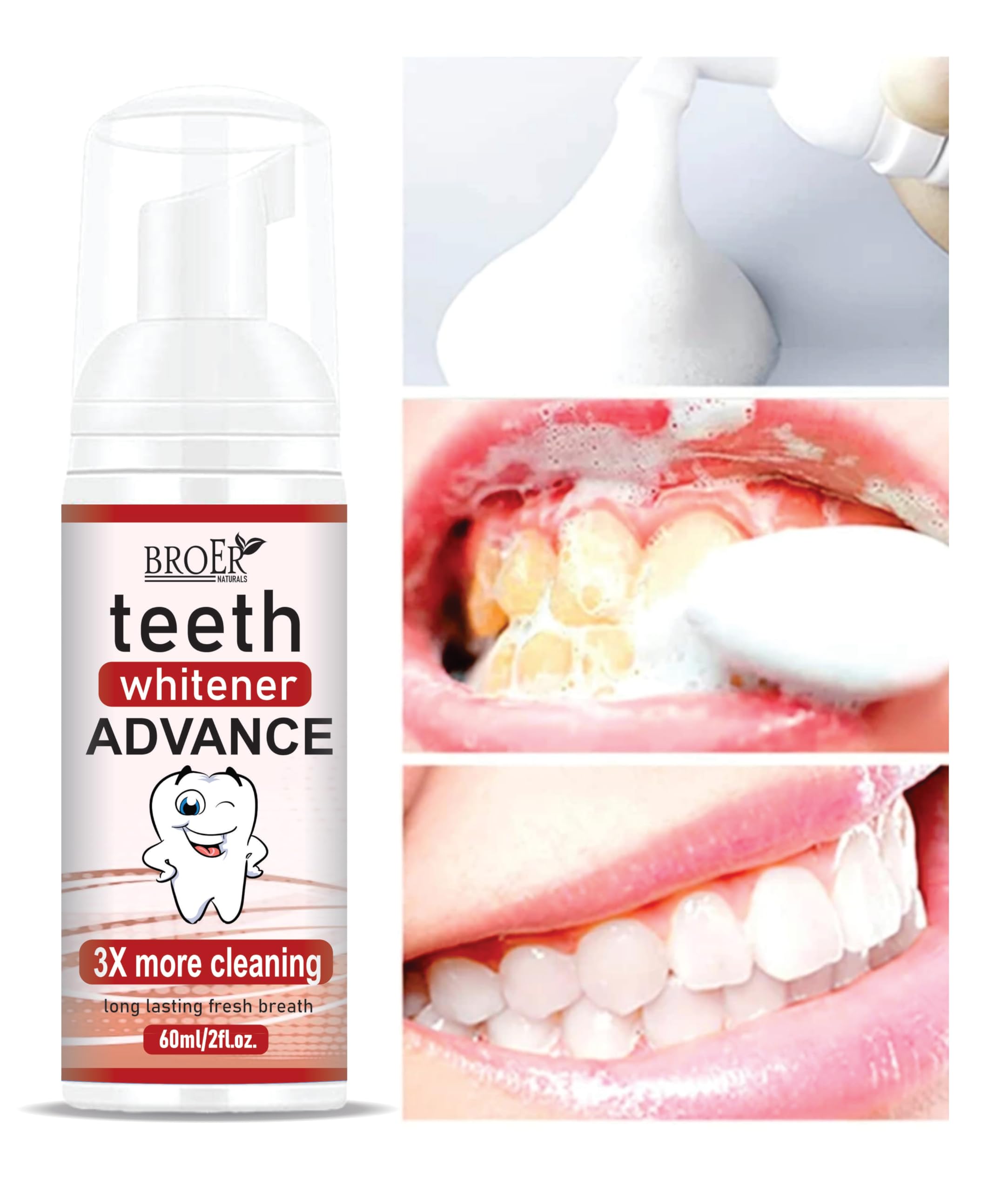 BROER Teeth Whitener ADVANCE | Teeth Whitening Foam To Remove Yellow Stains, Tobacoo, Tartar and Tobacco Stains - 60ml (B0CKWG6BG2) Amazon Price History, Amazon Price Tracker