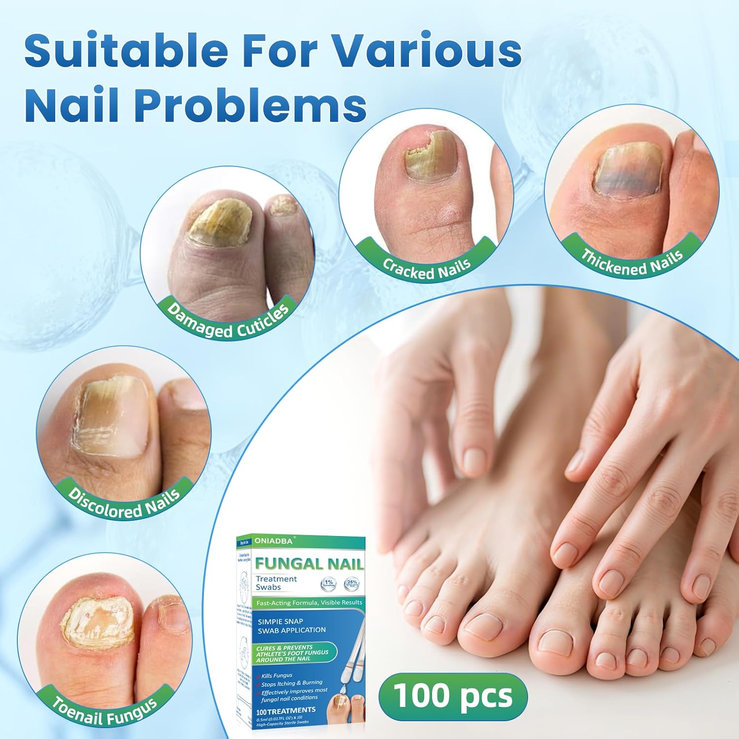Fungal Nail Treatment Swabs–100 Ct, Extra Strength Toenail & Athlete’s Foot Fungus Treatment with 25% Undecylenic Acid, Damaged, Discolored & Thick Nails, Restores Healthy Nail Growth - Image 2