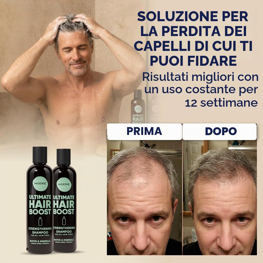 Moérie shampoo crescita capello premium per lunghi e folti, volumizzante vegan-friendly senza parabeni o silicone per tutti, shampoo anticadulla uomo e donna (250 ml) x2