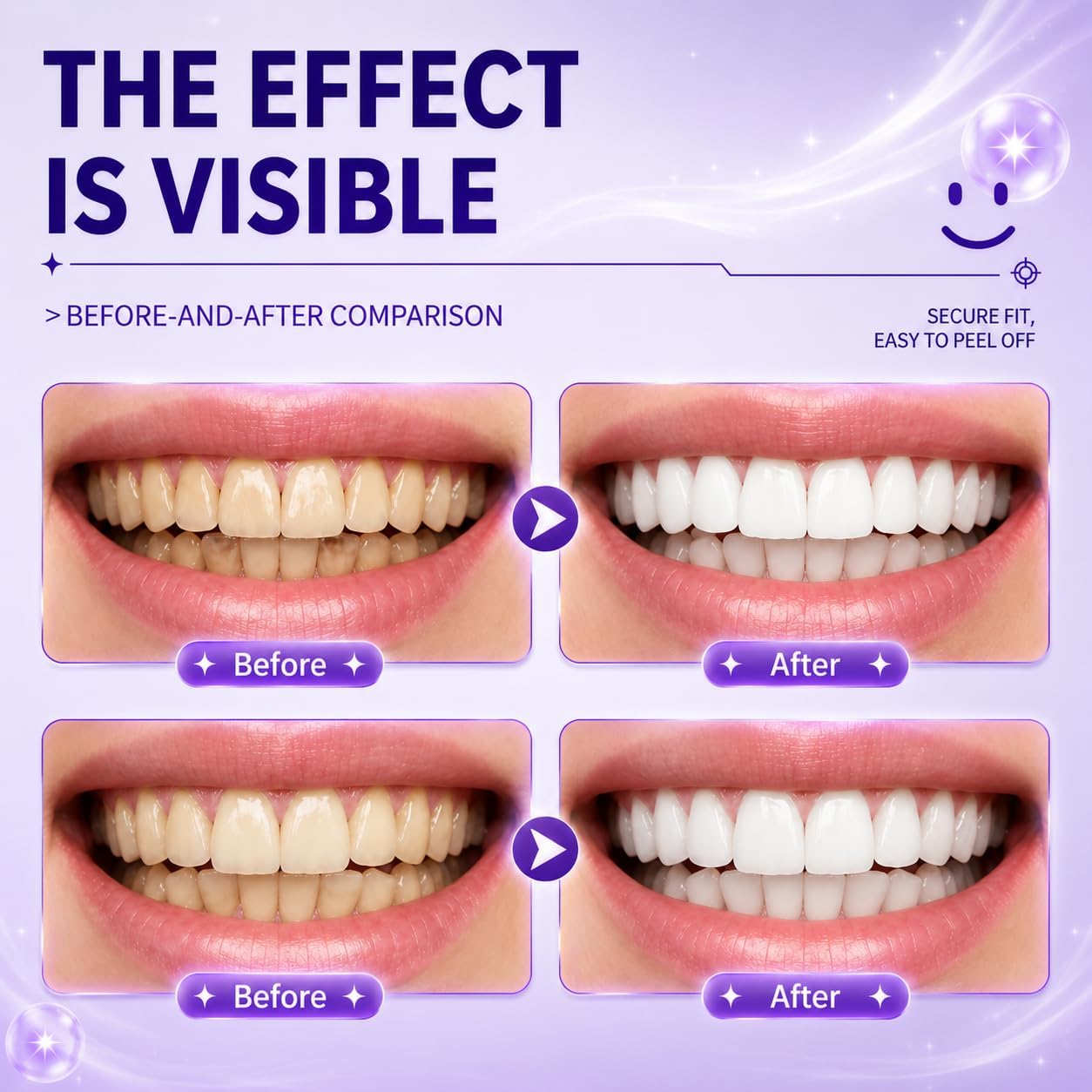 Purple Teeth Whitening Strips,Surface Stain Reduction & Natural Shine,Gentle Teeth Whitening in 30 Minutes,Safely Protects Tooth，Portable for Home or Out Use Non-Slip (28 Strips, Mint)