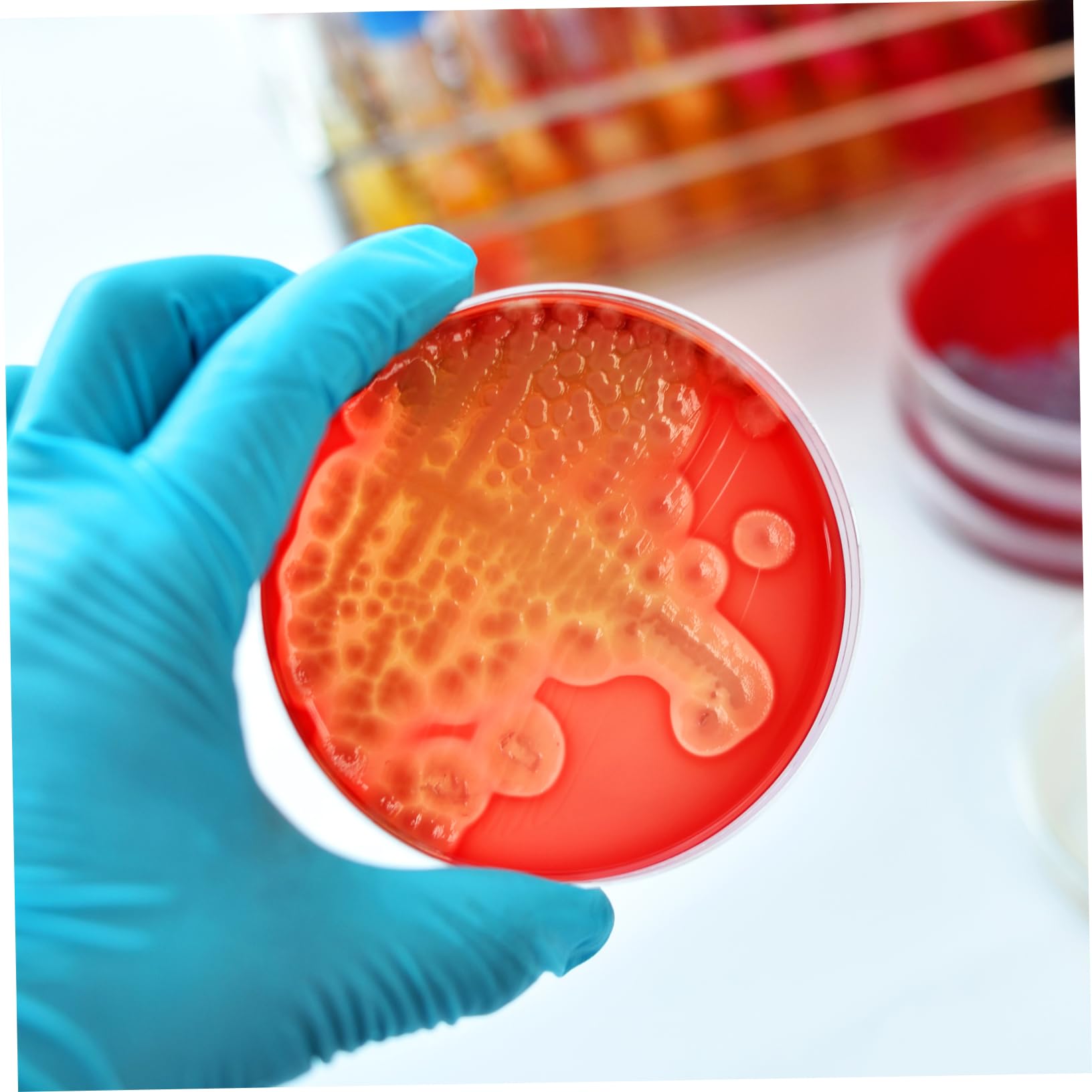 Piastra di Coltura con Agar 20 Pezzi 7cm per Esperimenti