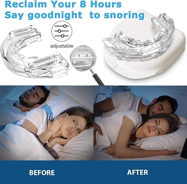 Gouttière Anti Ronflement,Orthèse anti-ronflement,Goutiere Dent Bruxisme,Il RéSout Efficacement Le ProblèMe Du Ronflement Pendant Le Sommeil,Anti-ronflements réglables en silicone anti-ronflement - 2