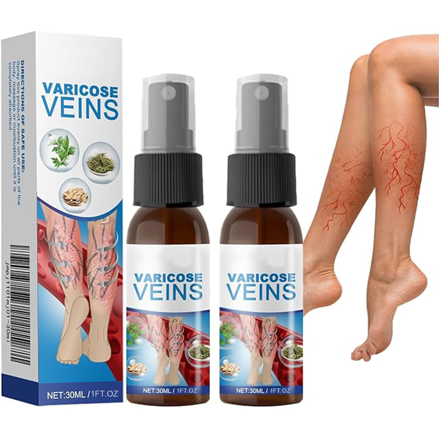 Makbeaty Varicose Vein Soothing Spray, Varicose Veins Cream Relief Phlebitis Angiitis Varices Inflammation Care Spray(2 Pcs)