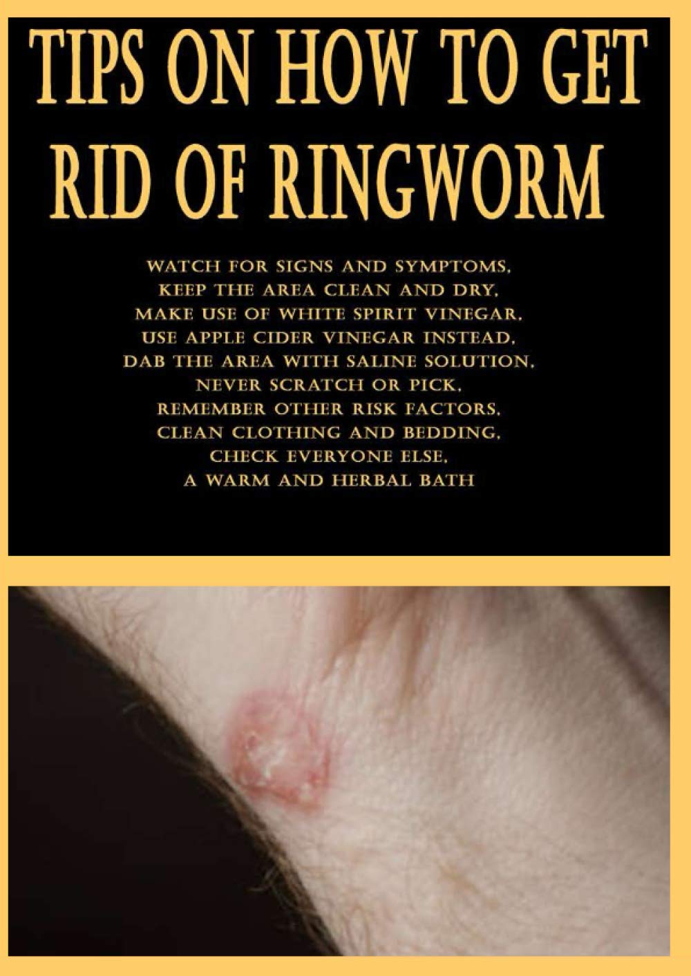 Apple Cider Vinegar For Ringworm ubicaciondepersonas.cdmx.gob.mx