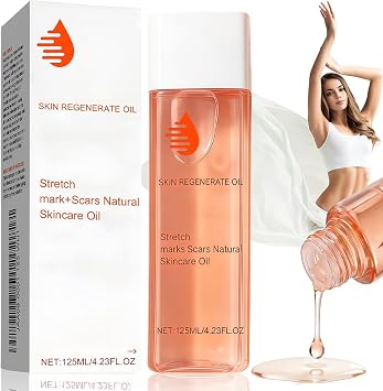 Stretch Mark Oil, Oil Stretch Mark & Scar Treatment, Boosts Collagen, Lifts Skin, Improves Stretch Marks, Scars & Uneven Tone,125ml