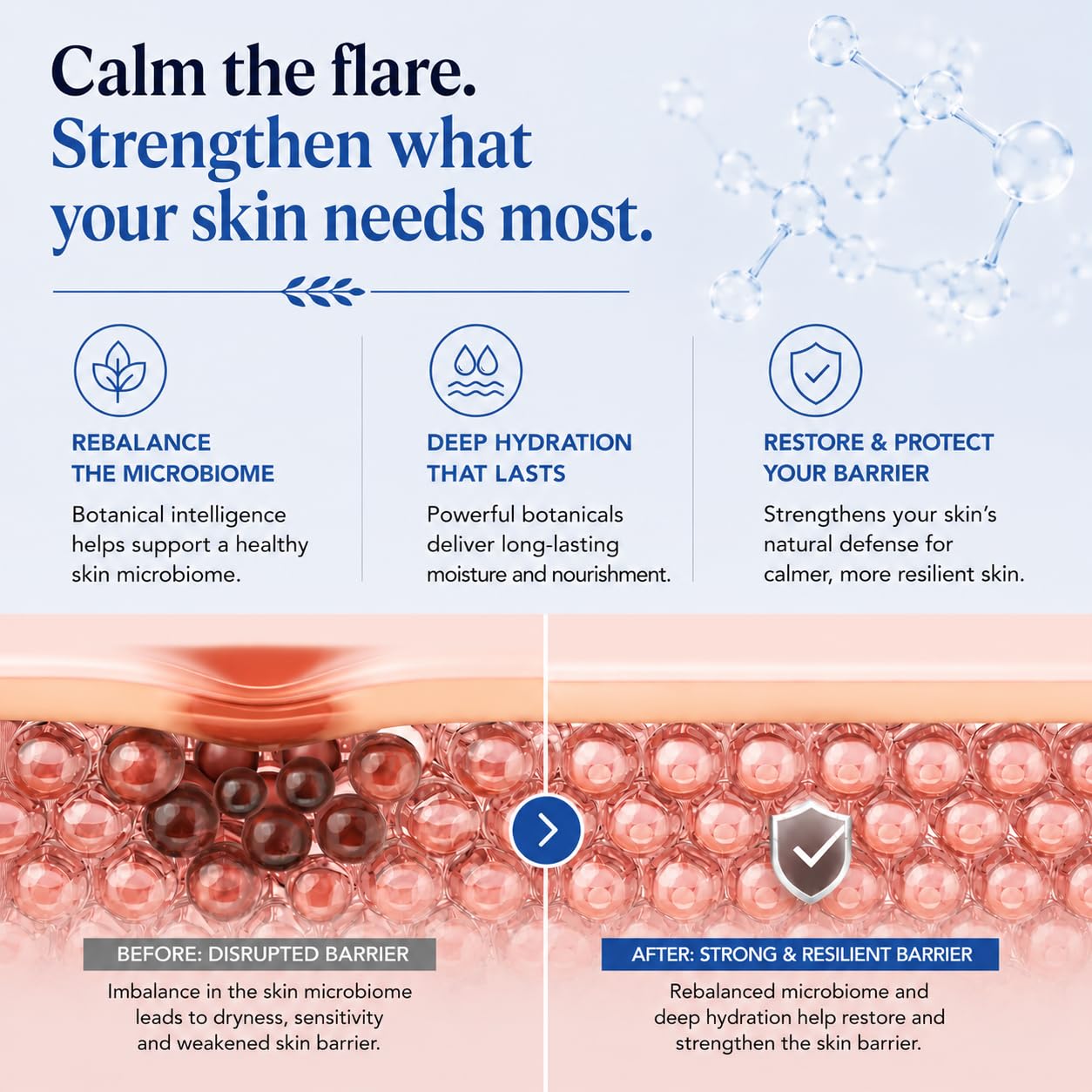 KAMEDIS Beruhigende Körpercreme für Ekzemtherapie Patentierter botanischer Komplex Klinisch bewährt für juckende, trockene und gereizte Haut. Von Dermatologen empfohlene feuchtigkeitsspendende