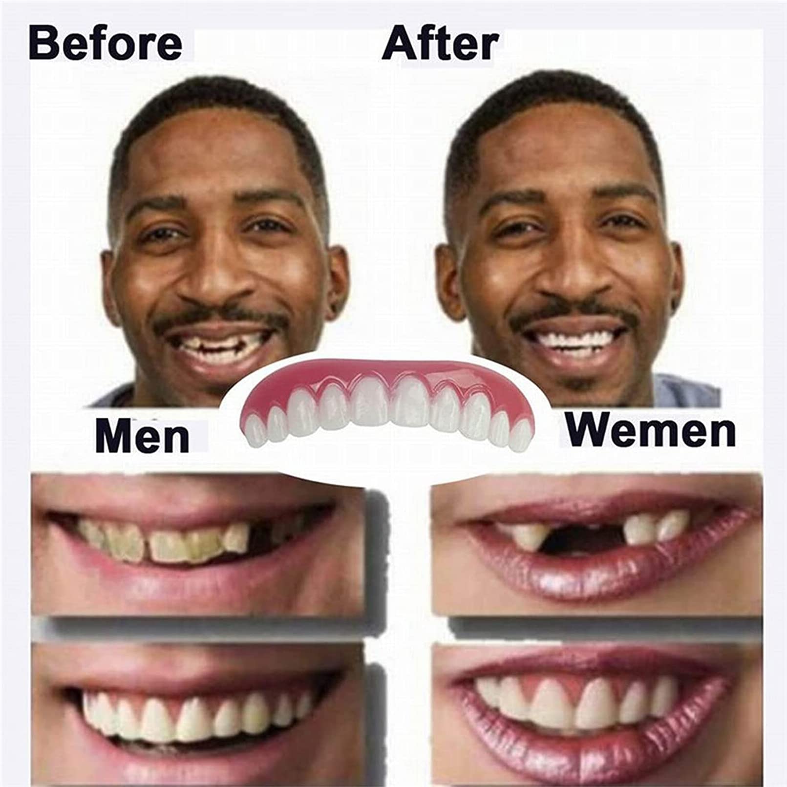 Protesi Dentale Naturale Gel di Silice Faccette Dentali Inferiore e Superiore Cosmetici Denti Ripara Istantaneamente i Denti e Sorridi per Uomini e Donne,4 Pairs
