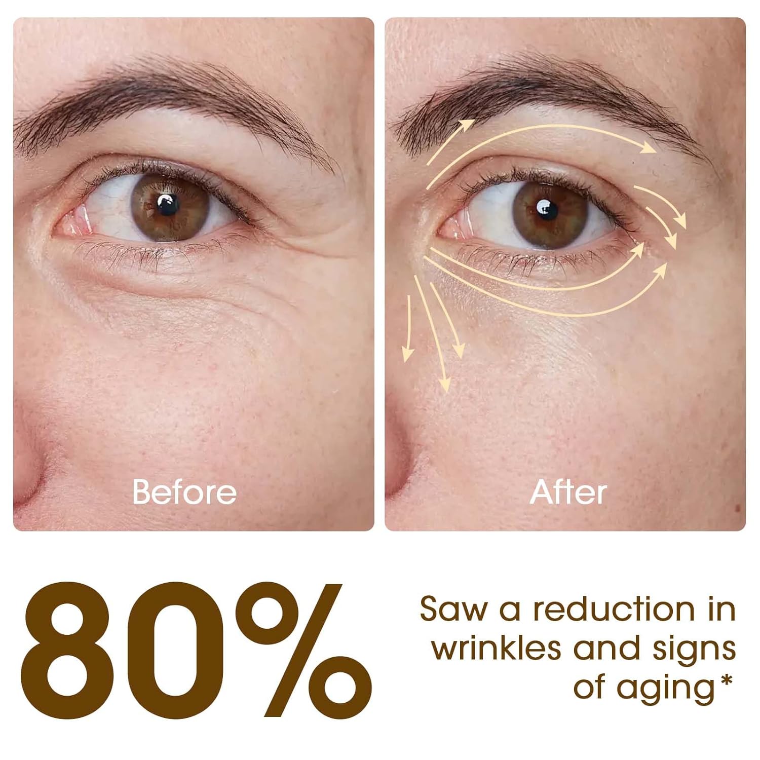 Eye Anti-wrinkle and wrinkle removal Device, Eye Patches with Hydrocolloids Collagen gel, for Dark Circles, Wrinkles & Puffiness & Smile lines