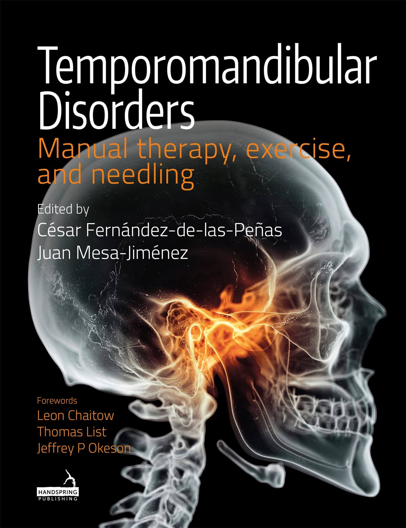 Temporomandibular Disorders by Cesar Fernandez-De-Las-Penas (Paperback Book)