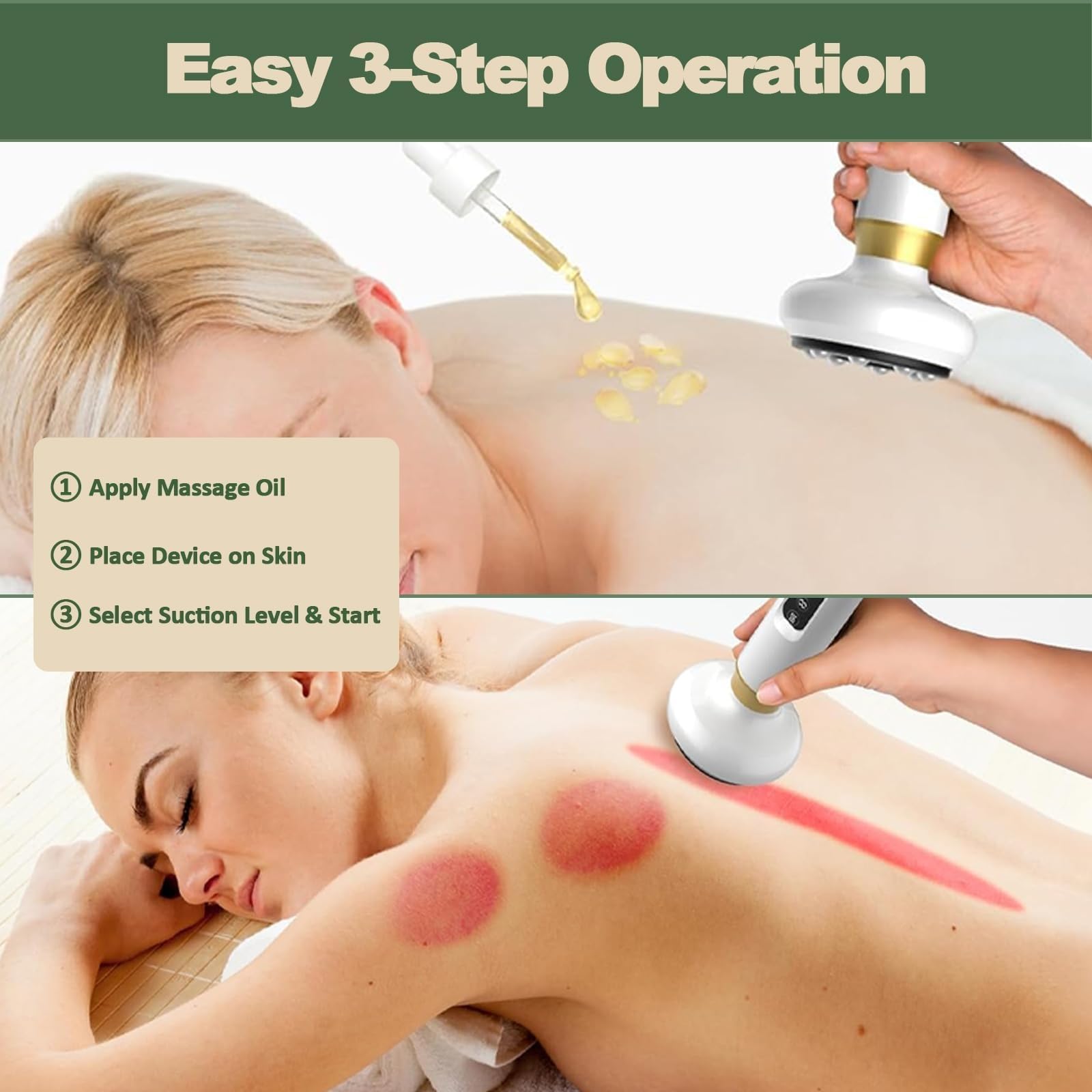 Máquina Celulitis Ventosa, Masajeador Anticelulítico Reductor Eléctrico, 12 Niveles de Calor, 12 Niveles de Succión, Reafirma la Piel, Reduce la Celulitis