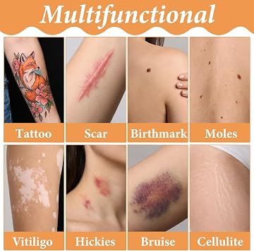 20 Pcs Tattoo Cover Up Patch,Ultra-Thin Waterproof Tattoo Cover Up Tape Breathable Temporary Tattoos Cover-Up Patches for Tattoos/Scars/Bruises,Cuttable
