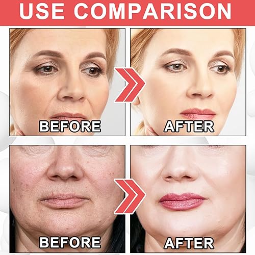 Miniatura 4 de Eelhoe Up, Up Serum Antiedad, Eelhoe up Premium, suero Eelhoe up, suero antienvejecimiento con colágeno para todo tipo de piel (1 unidad)