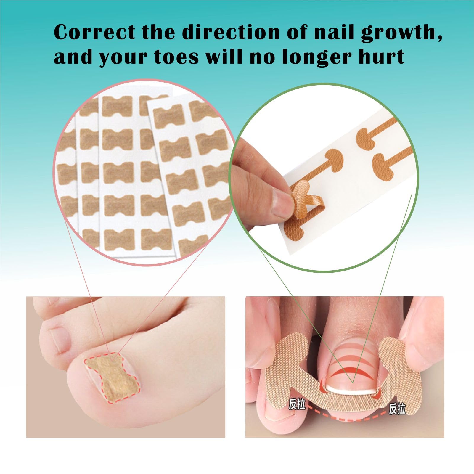 60Pcs Ingrown Toenail Stickers and 40Pcs Breathable Ingrown Toenail Corrector Patches, with Ingrown Toenail Tool - Image 4