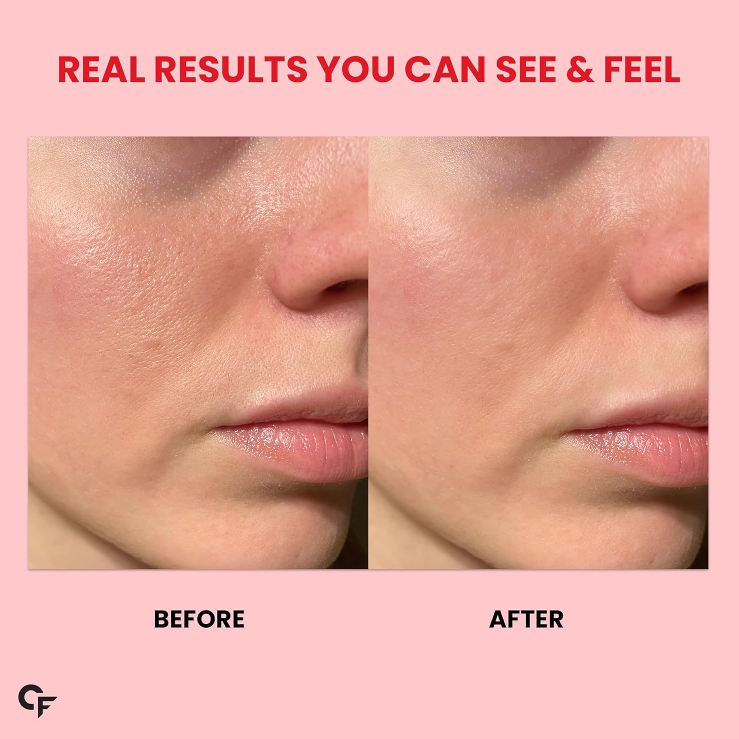 Carbamide Fort 100% Vegetarian Collagen Dose for Skin and Hair. Plant based collagen tablet for women and men | Vegetarian supplements that can support young and bright skin tones. Vegetarian Tablet for women and men | Vegetarian pills with biotin, zinc, manganese, vitamin C, vitamin E & B-complex that can support bright and young skin. 90 bullets Carbamide Fort 100% Vegetarian Collagen Dose for Skin and Hair. Plant based collagen tablet for women and men | Vegetarian supplements that can support young and bright skin tones. Vegetarian Tablet for women and men | Vegetarian pills with biotin, zinc, manganese, vitamin C, vitamin E & B-complex that can support bright and young skin. 90 bullets