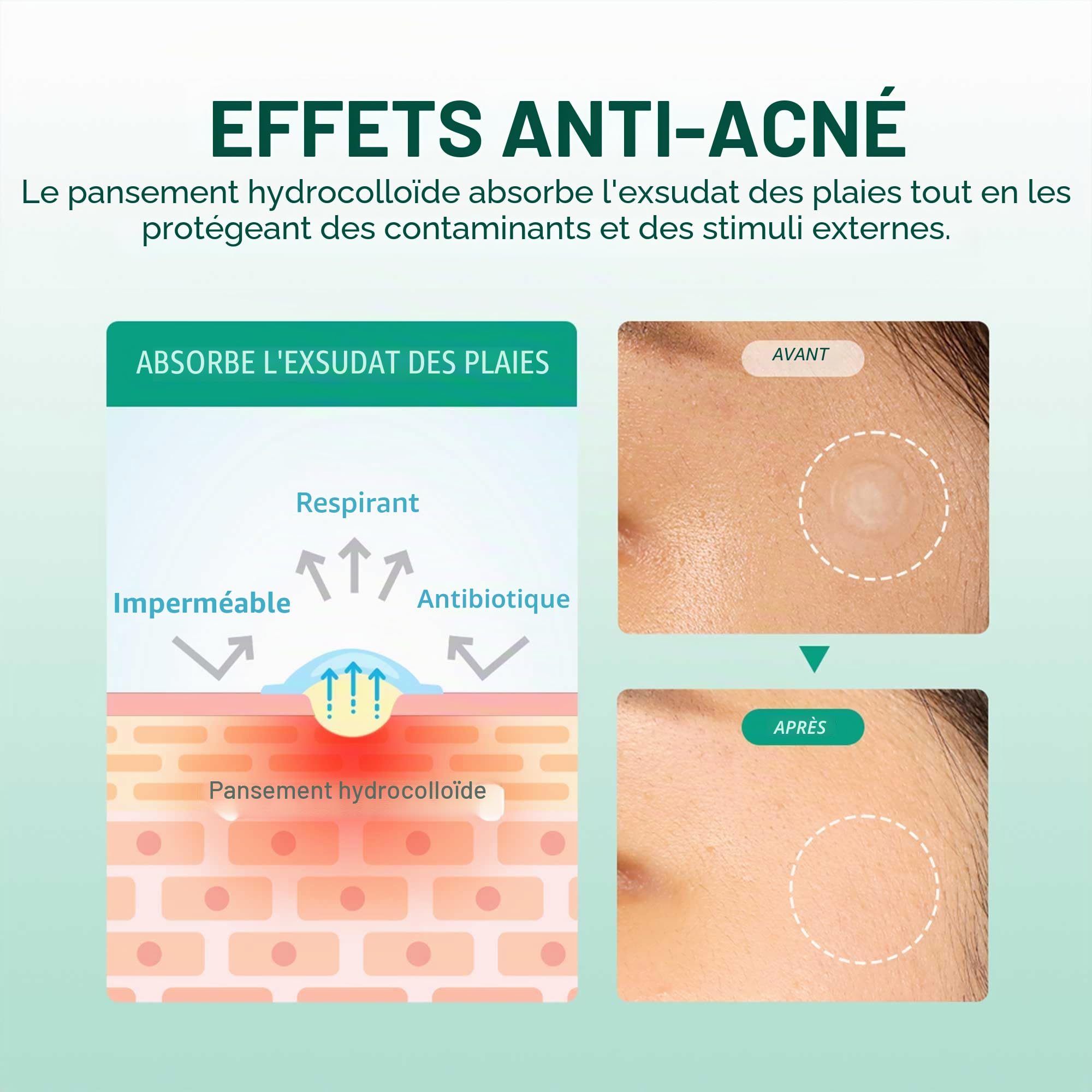SOMEBYMI 30 days Miracle Clear Spot Patches