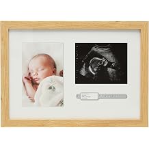 Kate & Milo Sonogram, Hospital Bracelet and Baby Photo Keepsake Frame